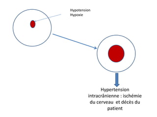 Hypotension
Hypoxie
Hypertension
intracrânienne : ischémie
du cerveau et décès du
patient
 