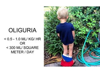 OLIGURIA
< 0.5 - 1.0 ML/ KG/ HR
OR
< 300 ML/ SQUARE
METER / DAY
 