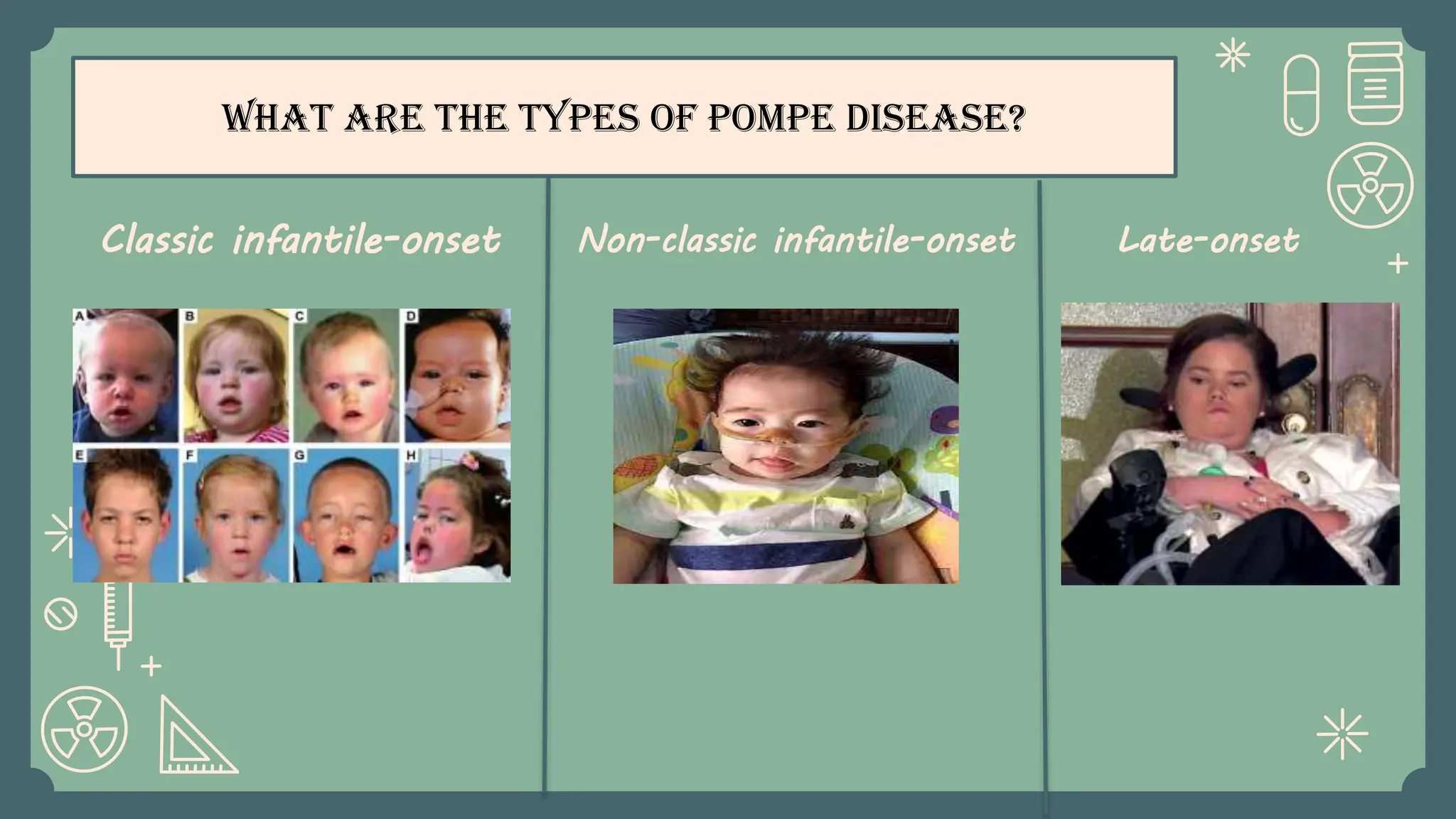 pompe-disease. its definition-study. pptx | PPTX
