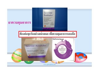 ยาควบคุมอาการ

      ตองพนทุกวันอยางสม่ําเสมอ เพื่อควบคุมอาการหอบหืด
 