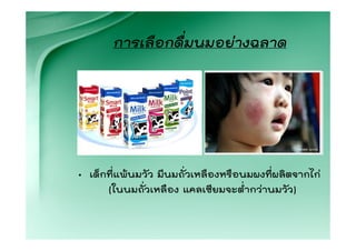 การเลือกดื่มนมอยางฉลาด




• เด็กที่แพนมวัว มีนมถั่วเหลืองหรือนมผงที่ผลิตจากไก
      (ในนมถัวเหลือง แคลเซียมจะต่ํากวานมวัว)
              ่
 