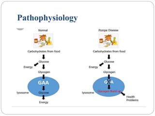 Pathophysiology
 