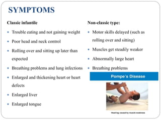 SYMPTOMS
Classic infantile
 Trouble eating and not gaining weight
 Poor head and neck control
 Rolling over and sitting up later than
expected
 Breathing problems and lung infections
 Enlarged and thickening heart or heart
defects
 Enlarged liver
 Enlarged tongue
Non-classic type:
 Motor skills delayed (such as
rolling over and sitting)
 Muscles get steadily weaker
 Abnormally large heart
 Breathing problems
 