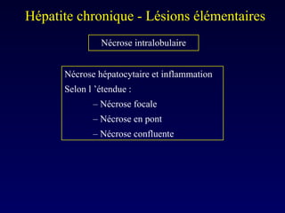 Hépatite chronique - Lésions élémentaires  Nécrose hépatocytaire et inflammation Selon l ’étendue : –  Nécrose focale –  Nécrose en pont –  Nécrose confluente Nécrose intralobulaire 