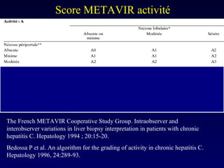 Bedossa P et al. An algorithm for the grading of activity in chronic hepatitis C. Hepatology 1996, 24:289-93. Score METAVIR activité  The French METAVIR Cooperative Study Group. Intraobserver and interobserver variations in liver biopsy interpretation in patients with chronic hepatitis C. Hepatology 1994 ; 20:15-20. 