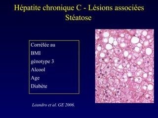 Corrélée au  BMI génotype 3 Alcool Age Diabète  Hépatite chronique C - Lésions associées Stéatose Leandro et al. GE 2006. 