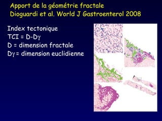 Apport de la géométrie fractale Dioguardi et al. World J Gastroenterol 2008  Index tectonique   TCI = D-D  D = dimension fractale D  = dimension euclidienne 