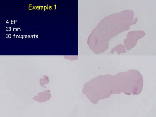 4 EP 13 mm  10 fragments   Exemple 1 