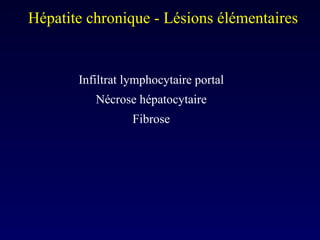 Infiltrat lymphocytaire portal Nécrose hépatocytaire Fibrose Hépatite chronique - Lésions élémentaires  