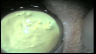 La procédure (vidéo) 
 