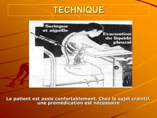 TECHNIQUE
Le patient est assis confortablement. Chez le sujet craintif,
une prémédication est nécessaire
 