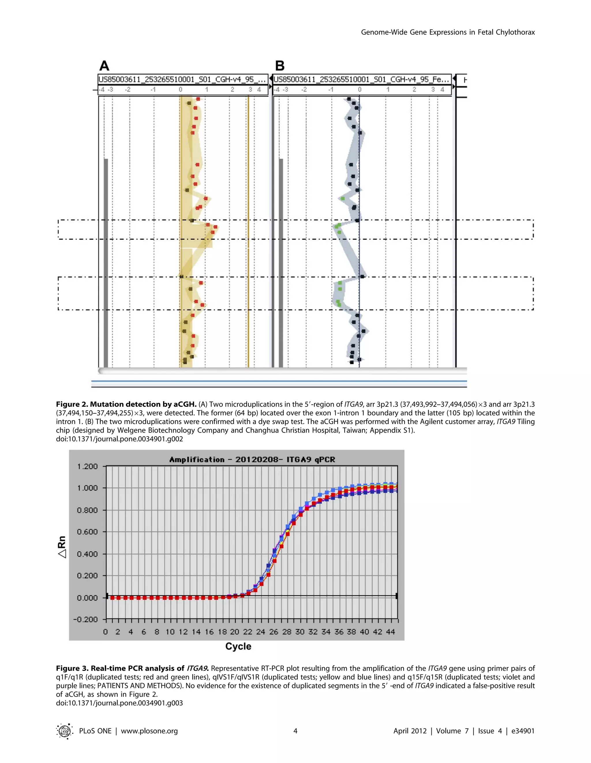 Genome-Wide Gene Expressions in Fetal Chylothorax 
Figure 2. Mutation detection by aCGH. (A) Two microduplications in the 59-region of ITGA9, arr 3p21.3 (37,493,992–37,494,056)63 and arr 3p21.3 
(37,494,150–37,494,255)63, were detected. The former (64 bp) located over the exon 1-intron 1 boundary and the latter (105 bp) located within the 
intron 1. (B) The two microduplications were confirmed with a dye swap test. The aCGH was performed with the Agilent customer array, ITGA9 Tiling 
chip (designed by Welgene Biotechnology Company and Changhua Christian Hospital, Taiwan; Appendix S1). 
doi:10.1371/journal.pone.0034901.g002 
Figure 3. Real-time PCR analysis of ITGA9. Representative RT-PCR plot resulting from the amplification of the ITGA9 gene using primer pairs of 
q1F/q1R (duplicated tests; red and green lines), qIVS1F/qIVS1R (duplicated tests; yellow and blue lines) and q15F/q15R (duplicated tests; violet and 
purple lines; PATIENTS AND METHODS). No evidence for the existence of duplicated segments in the 59 -end of ITGA9 indicated a false-positive result 
of aCGH, as shown in Figure 2. 
doi:10.1371/journal.pone.0034901.g003 
PLoS ONE | www.plosone.org 4 April 2012 | Volume 7 | Issue 4 | e34901 
 