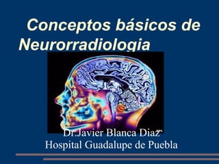 Conceptos básicos de
Neurorradiologia
Dr.Javier Blanca Diaz
Hospital Guadalupe de Puebla
 
