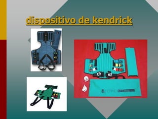 dispositivo de kendrick
 