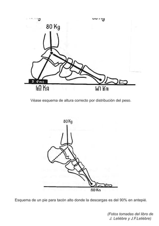 Véase esquema de altura correcto por distribución del peso.
Esquema de un pie para tacón alto donde la descargas es del 90% en antepié.
(Fotos tomadas del libro de
J. Leliébre y J.F.Leliébre)
 