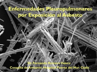 Dr. Fernando Romero Valero  Consulta de Amianto. Hospital Puerta del Mar. Cádiz Enfermedades Pleuropulmonares por Exposición al Asbesto 