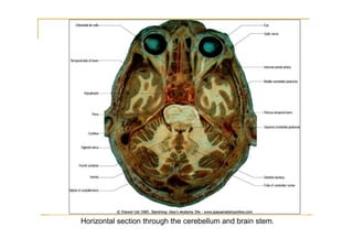 Horizontal section through the cerebellum and brain stem.
 