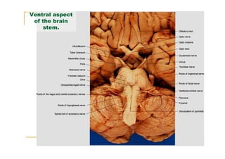 Ventral aspect
 of the brain
    stem.
 