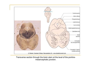 Transverse section through the brain stem at the level of the pontine-
                      mesencephalic junction.
 