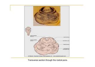 Transverse section through the rostral pons.
 