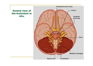 Ventral view of
the brainstem in
      situ.
 