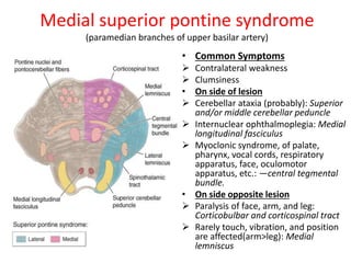 Medial superior pontine syndrome
(paramedian branches of upper basilar artery)
• Common Symptoms
 Contralateral weakness
 Clumsiness
• On side of lesion
 Cerebellar ataxia (probably): Superior
and/or middle cerebellar peduncle
 Internuclear ophthalmoplegia: Medial
longitudinal fasciculus
 Myoclonic syndrome, of palate,
pharynx, vocal cords, respiratory
apparatus, face, oculomotor
apparatus, etc.: —central tegmental
bundle.
• On side opposite lesion
 Paralysis of face, arm, and leg:
Corticobulbar and corticospinal tract
 Rarely touch, vibration, and position
are affected(arm>leg): Medial
lemniscus
 