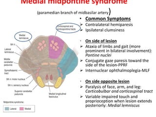 Medial midpontine syndrome
(paramedian branch of midbasilar artery)
• Common Symptoms
 Contralateral hemiparesis
 Ipsilateral clumsiness
• On side of lesion
 Ataxia of limbs and gait (more
prominent in bilateral involvement):
Pontine nuclei
 Conjugate gaze paresis toward the
side of the lesion-PPRF
 Internuclear ophthalmoplegia-MLF
• On side opposite lesion
 Paralysis of face, arm, and leg:
Corticobulbar and corticospinal tract
 Variable impaired touch and
proprioception when lesion extends
posteriorly: Medial lemniscus
 