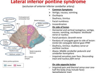 Lateral inferior pontine syndrome
(occlusion of anterior inferior cerebellar artery)
• Common Symptoms
 Vertigo, nausea, vomiting
 Oscillopsia
 Deafness, tinnitus
 Facial numbness
 Incoordination
• On side of lesion
 Horizontal and vertical nystagmus, vertigo,
nausea, vomiting, oscillopsia: Vestibular
nerve or nucleus
 Facial paralysis: Seventh nerve
 Paralysis of conjugate gaze to side of lesion:
Center for conjugate lateral gaze-PPRF
 Deafness, tinnitus: Auditory nerve or
cochlear nucleus
 Ataxia: Middle cerebellar peduncle and
cerebellar hemisphere
 Impaired sensation over face: Descending
tract and nucleus fifth nerve
• On side opposite lesion
 Impaired pain and thermal sense over one-
half the body (may include face):
Spinothalamic tract
 