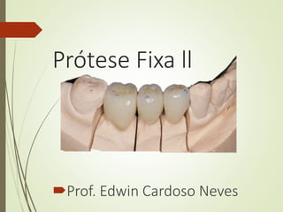 Prótese Fixa ll
Prof. Edwin Cardoso Neves
 