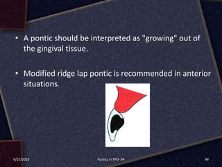 pontic in fpd | PPTX
