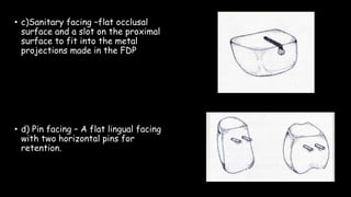 • c)Sanitary facing –flat occlusal
surface and a slot on the proximal
surface to fit into the metal
projections made in the FDP
• d) Pin facing – A flat lingual facing
with two horizontal pins for
retention.
 