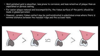 • Well-polished gold is smoother, less prone to corrosion, and less retentive of plaque than an
unpolished or porous casting.
• For easier plaque removal and biocompatibility, the tissue surface of the pontic should be
made in glazed porcelain
• However, ceramic tissue contact may be contraindicated in edentulous areas where there is
minimal distance between the residual ridge and the occlusal table.
 