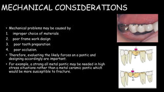 MECHANICAL CONSIDERATIONS
• Mechanical problems may be caused by
1. improper choice of materials
2. poor frame work design
3. poor tooth preparation
4. poor occlusion.
• Therefore, evaluating the likely forces on a pontic and
designing accordingly are important.
• For example, a strong all metal pontic may be needed in high
stress situations rather than a metal ceramic pontic which
would be more susceptible to fracture.
 