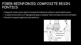 FIBER-REINFORCED COMPOSITE RESIN
PONTICS
• Composite resins can be used in fixed partial dentures without a metal substructure.
• A substructure matrix of impregnated glass or polymer fiber provides structural strength.
• Excellent marginal adaptation and esthetics
 