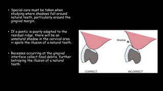 • Special care must be taken when
studying where shadows fall around
natural teeth, particularly around the
gingival margin.
• If a pontic is poorly adapted to the
residual ridge, there will be an
unnatural shadow in the cervical area
>> spoils the illusion of a natural tooth.
• Recesses occurring at the gingival
interface collect food debris, further
betraying the illusion of a natural
tooth.
 