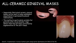 ALL-CERAMIC GINGIVAL MASKS
• Separately fabricated ceramic gingival
masks can be used to make subsequent
adjustments in permanently placed
restorations.
• This method is particularly suitable for
patients with a local alveolar ridge
defect that has not been corrected by
augmentation of the soft tissue.
Daniel E , H Spiekermann: A review of esthetic pontic design options. Quintessence Int 2002;33:736-746
 