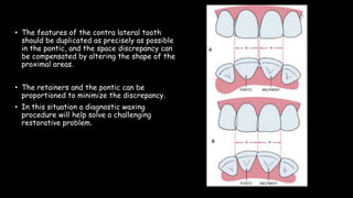 • The features of the contra lateral tooth
should be duplicated as precisely as possible
in the pontic, and the space discrepancy can
be compensated by altering the shape of the
proximal areas.
• The retainers and the pontic can be
proportioned to minimize the discrepancy.
• In this situation a diagnostic waxing
procedure will help solve a challenging
restorative problem.
 