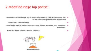 Pontic design and finish line.pptx