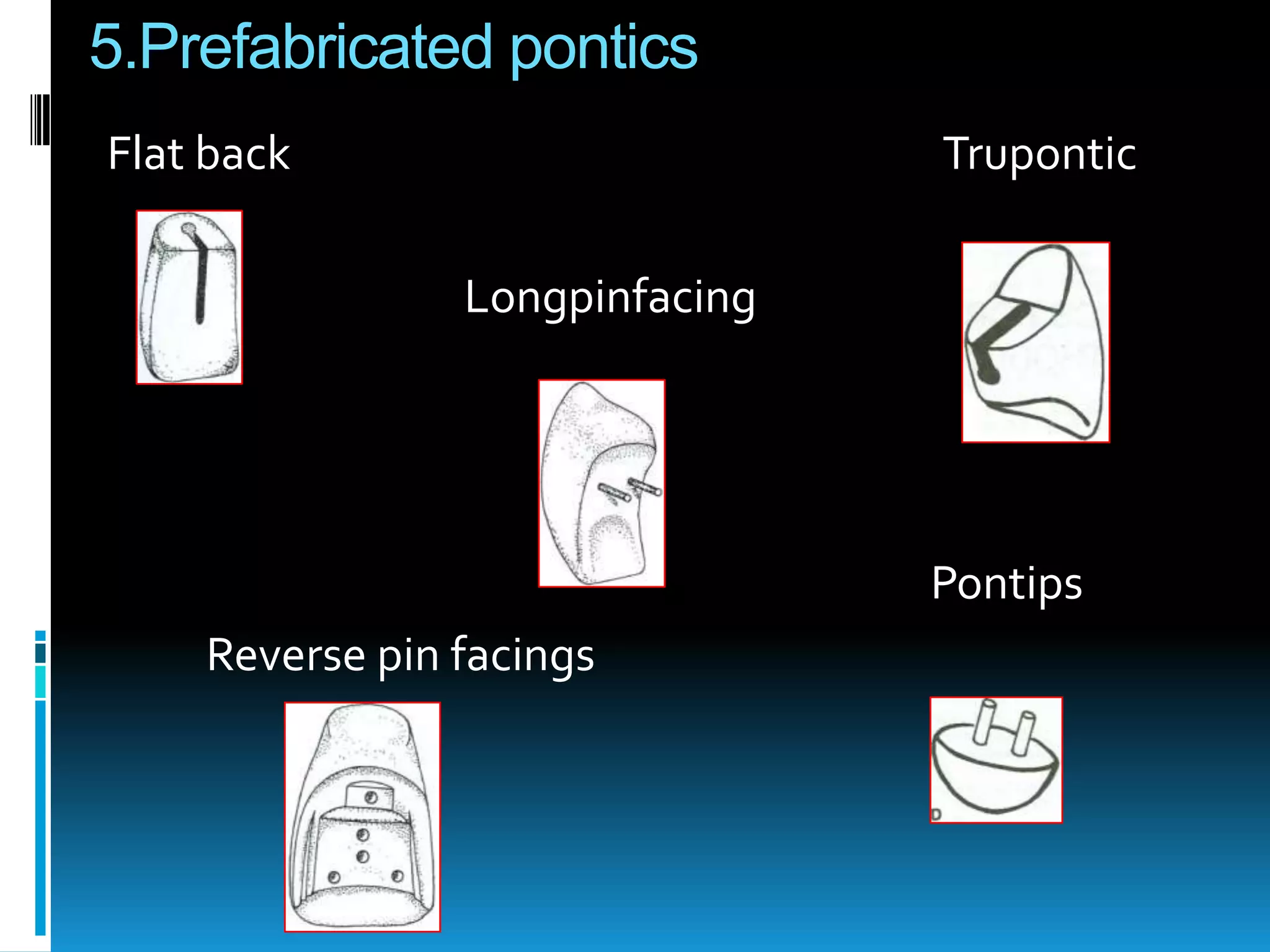Pontics | PPTX