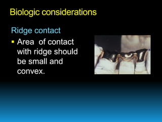 Biologic considerations

Ridge contact
 Area of contact
  with ridge should
  be small and
  convex.
 