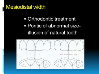 Mesiodistal width

        Orthodontic treatment
        Pontic of abnormal size-
         illusion of natural tooth
 