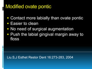 Modified ovate pontic

   Contact more labially than ovate pontic
   Easier to clean
   No need of surgical augmentation
   Push the labial gingival margin away to
    floss



Liu.S,J Esthet Restor Dent 16:273-283, 2004
 