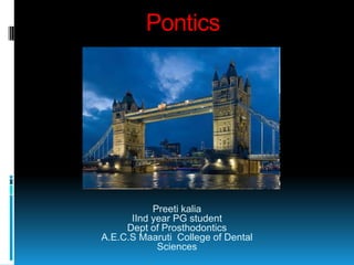 Pontics




           Preeti kalia
      IInd year PG student
     Dept of Prosthodontics
A.E.C.S Maaruti College of Dental
            Sciences
 