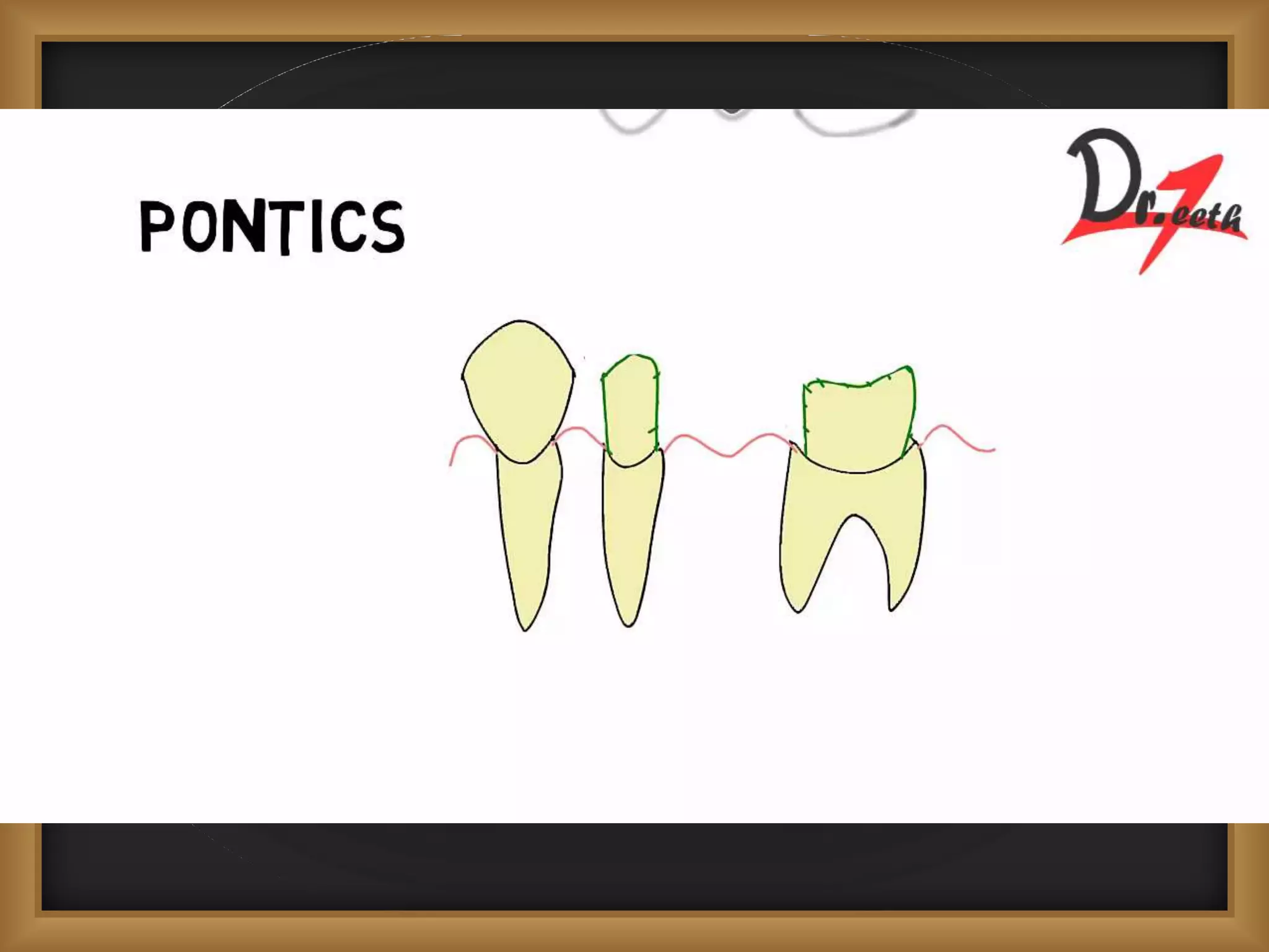 Pontics Kashish | PPTX