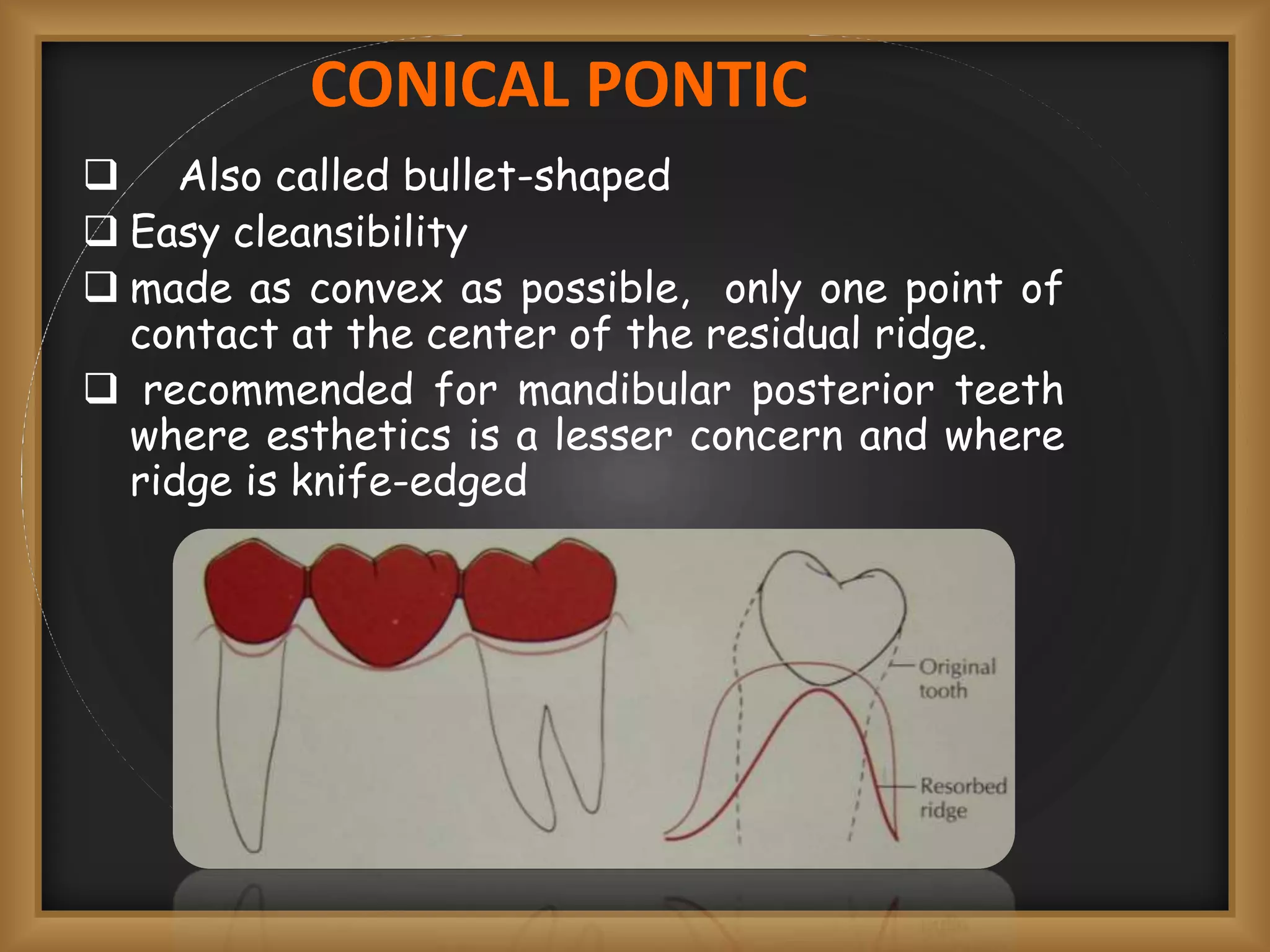 Pontics Kashish | PPT