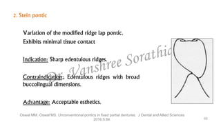 Ms Ridges Pontics | PPTX