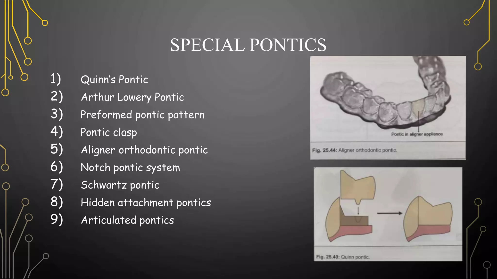 Pontics in Fixed Partial Denture | PPTX