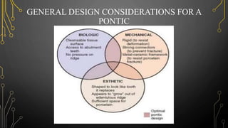 GENERAL DESIGN CONSIDERATIONS FOR A
PONTIC
 