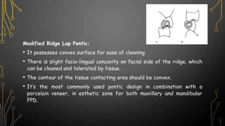 Modified Ridge Lap Pontic:
• It possesses convex surface for ease of cleaning.
• There is slight facio-lingual concavity on facial side of the ridge, which
can be cleaned and tolerated by tissue.
• The contour of the tissue contacting area should be convex.
• It’s the most commonly used pontic design in combination with a
porcelain veneer, in esthetic zone for both maxillary and mandibular
FPD.
 