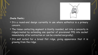 Ovate Pontic:
• It’s a round-end design currently in use where esthetics is a primary
concern.
• The tissue contacting segment is bluntly rounded, set into a concavity in
ridge(created by extending one quarter of provisional FPD into socket
immediately after extraction or can be created surgically).
• It’s well suited for a broad flat ridge, giving appearance that it is
growing from the ridge.
 